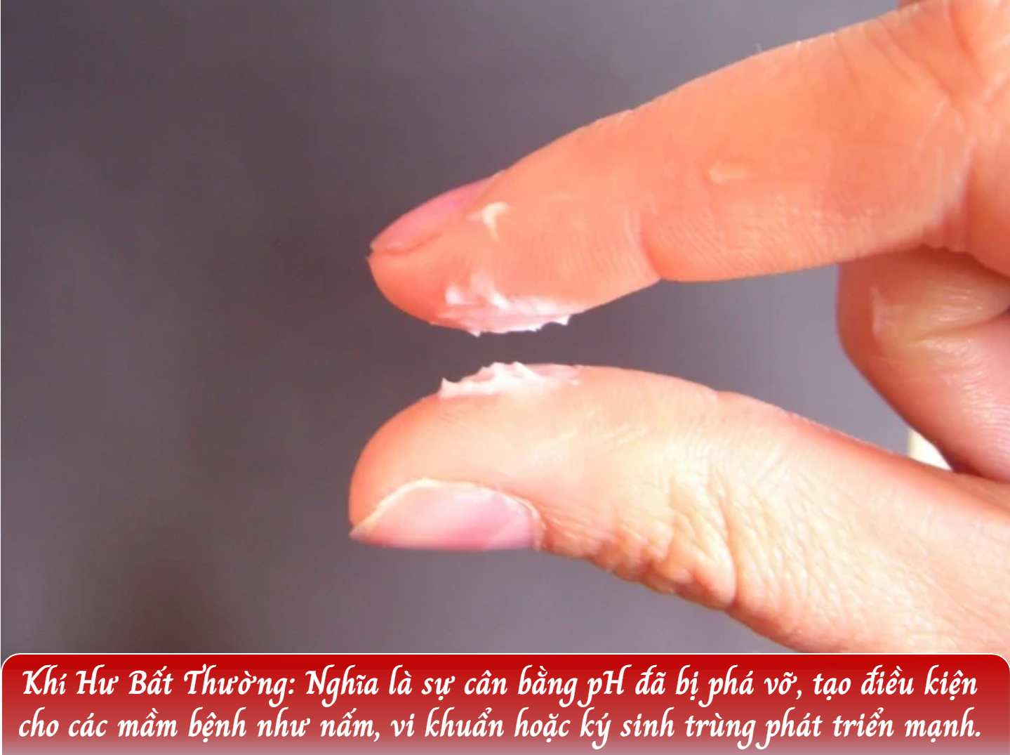 Triệu Chứng Bệnh Phụ Khoa