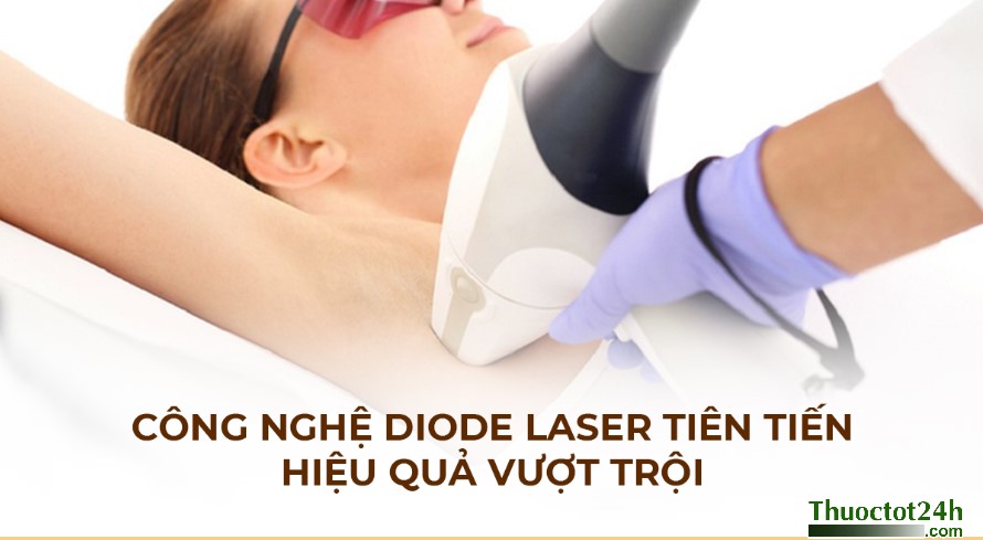 Triệt lông công nghệ laser