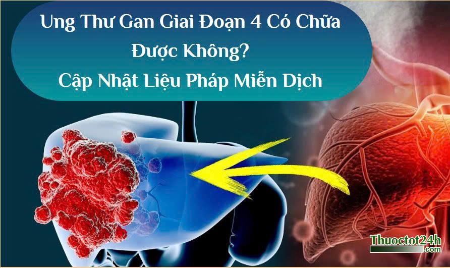 Ung thư gan giai đoạn 4 có chữa được không
