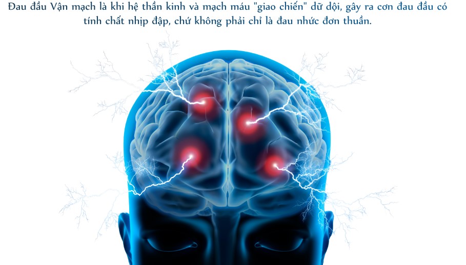 Đau đầu vận mạch